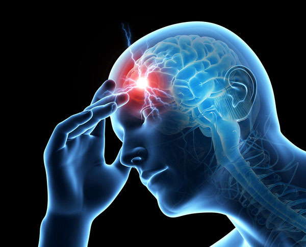 Migraine Diagnosis  Science of Migraine