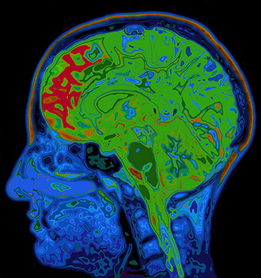 brain color scan
